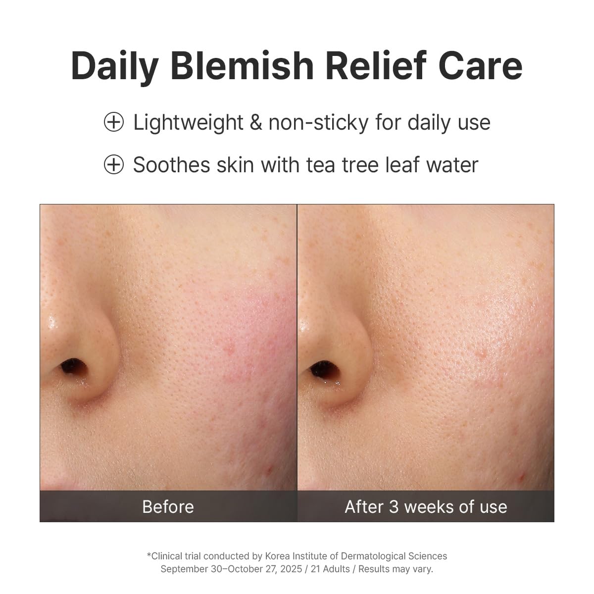 Dr.Althea 345 Relief Cream, 1.69 Fl Oz (Ver.2 - Pack of 1)